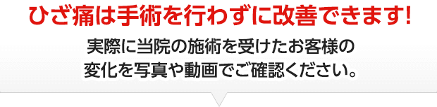 ひざ痛は手術を行わずに改善できます！